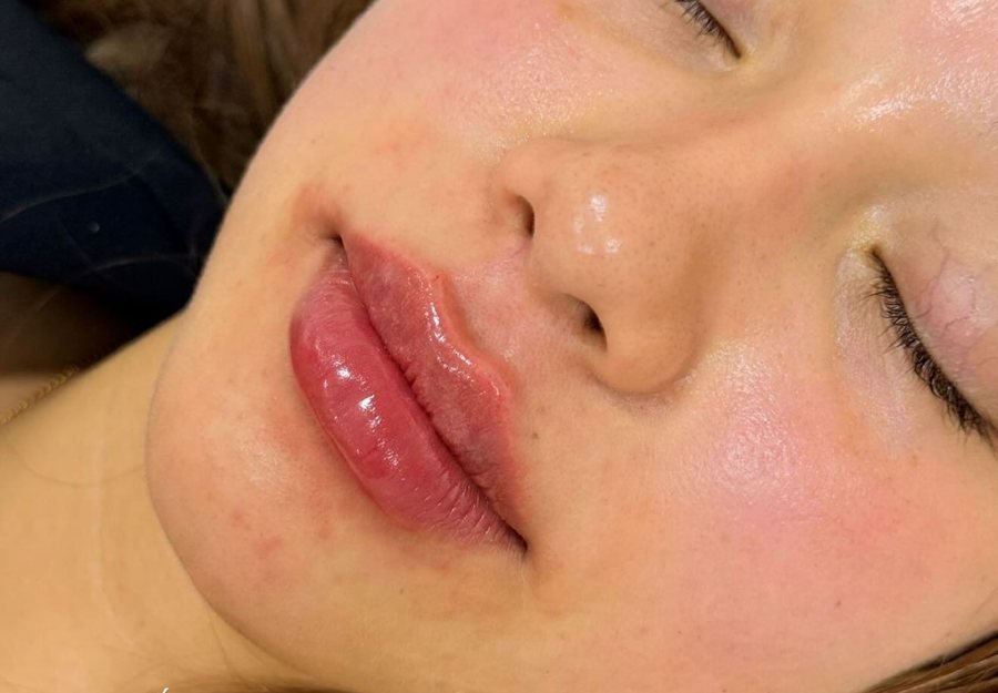 Después labios
